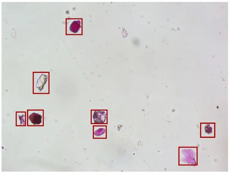 AI-Powered Magnetic Microplastic RemediationCombining Nanomaterials, AI & Microscopy for Sustainable Pollution Solutions01
